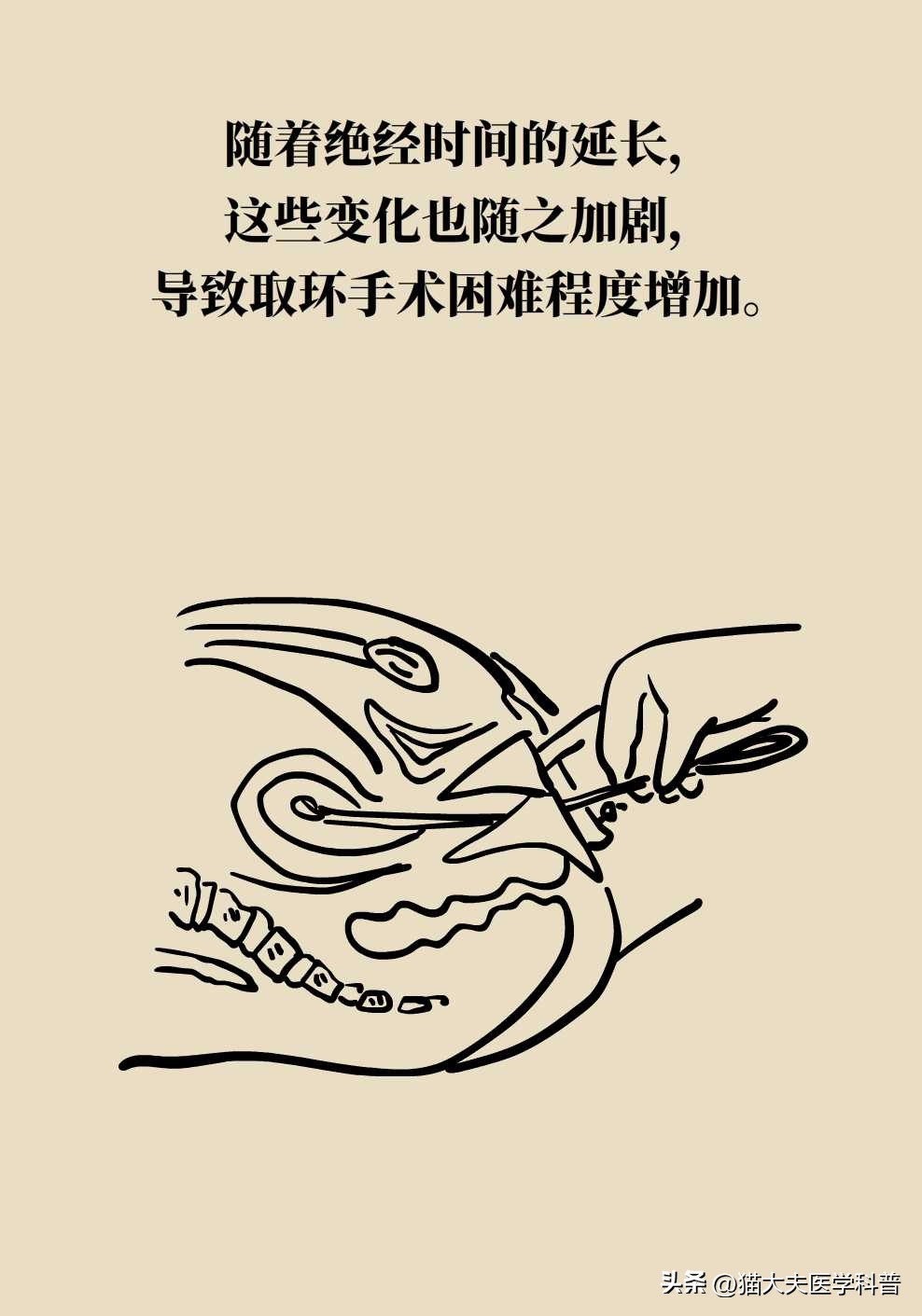 绝经后取环还会怀孕不,绝经后取环还能怀孕吗