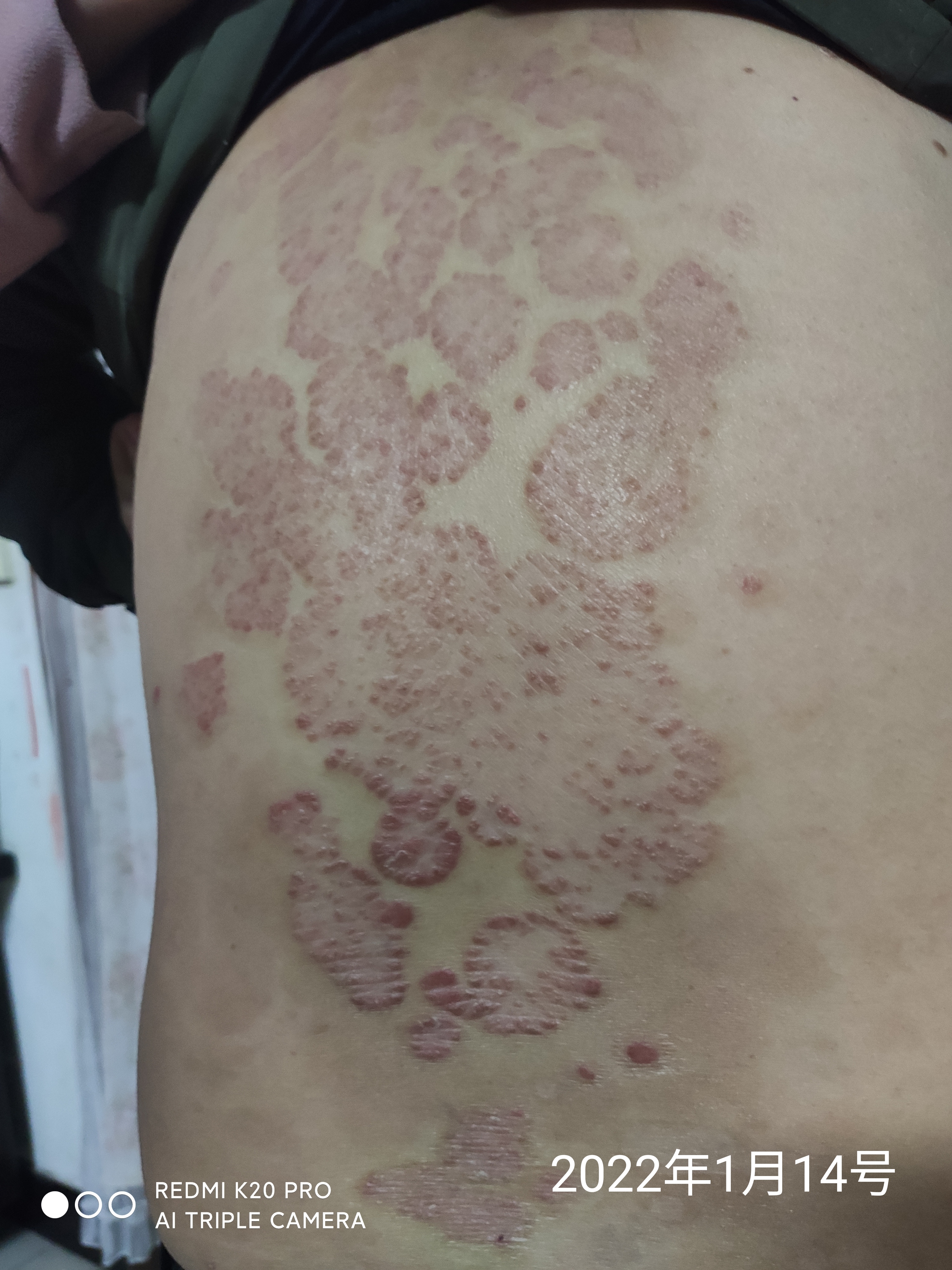 小牛-中牛-老牛-疯牛，牛皮癖患者悲怆的四步曲,随笔1