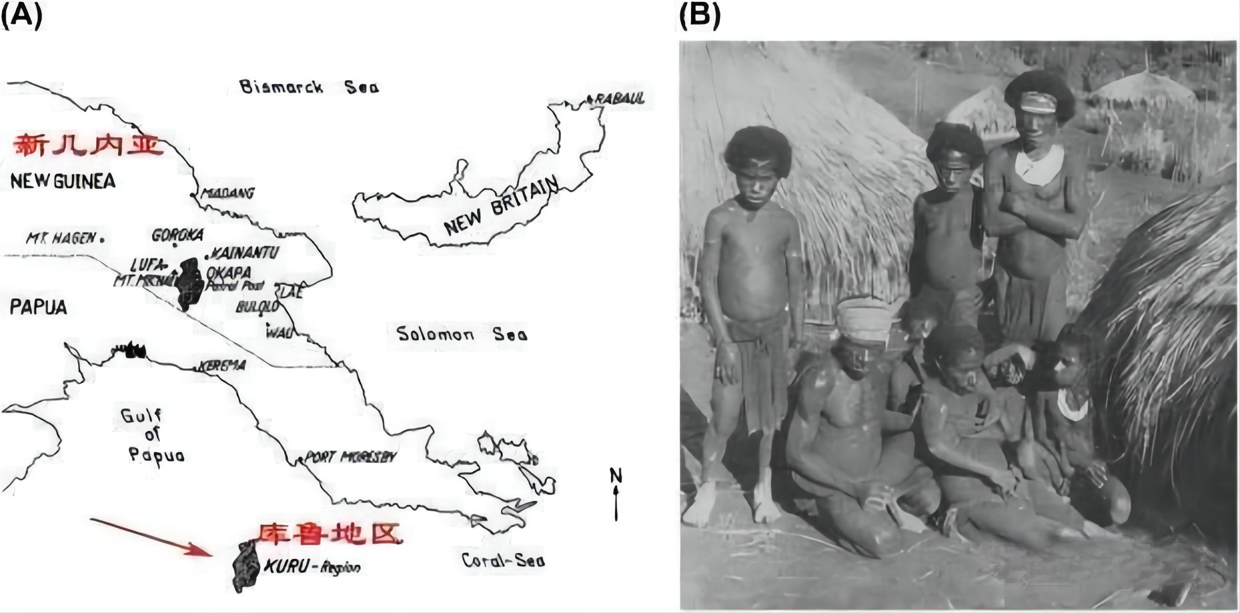 朊病毒防止人类自相残杀,致死率高达100%的病毒