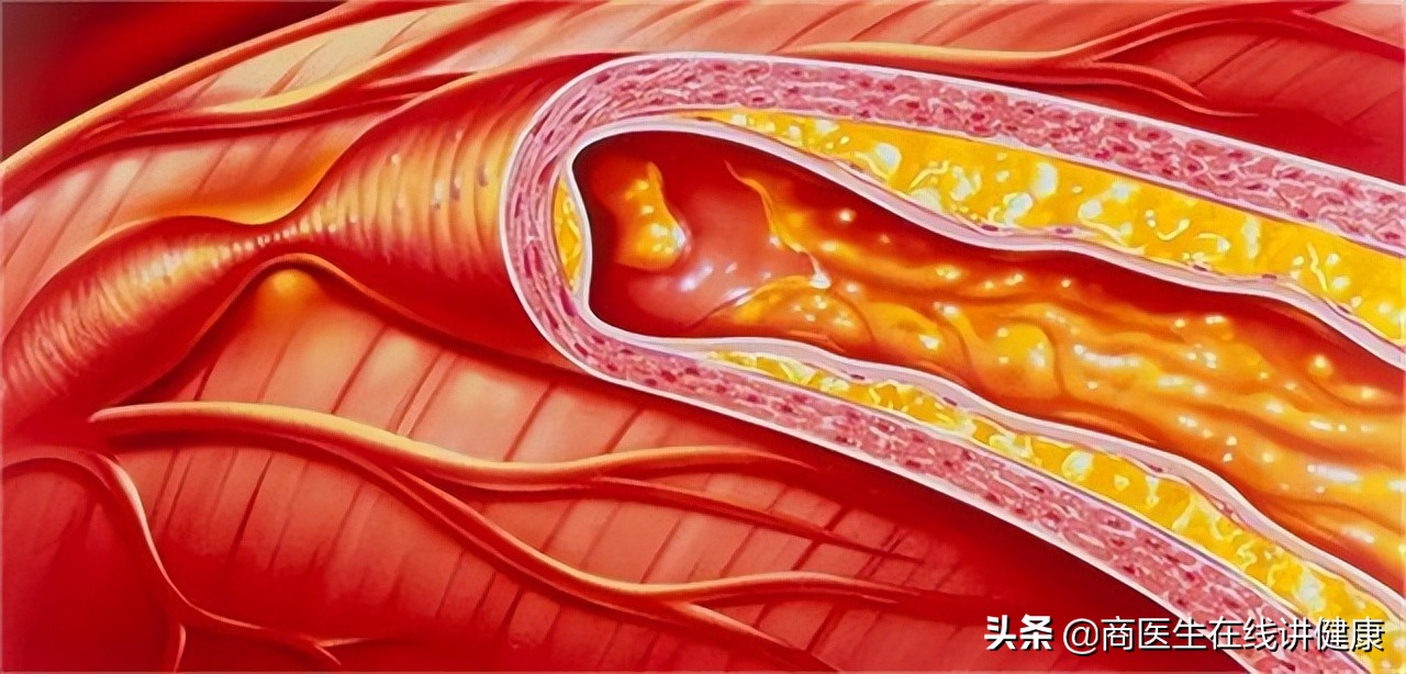 62岁男子因血糖过高死亡,弘一法师晚年得了糖尿病