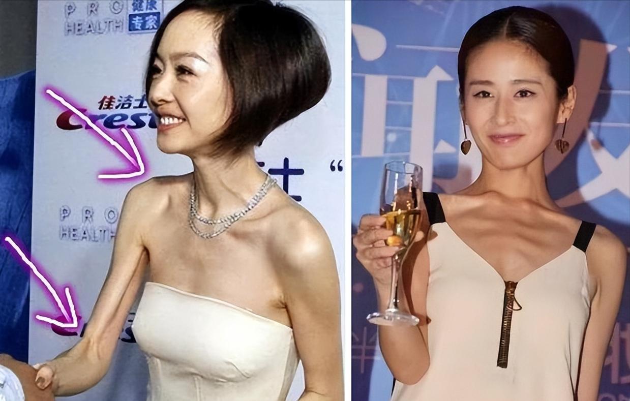 瘦到极致病态,瘦到病态美