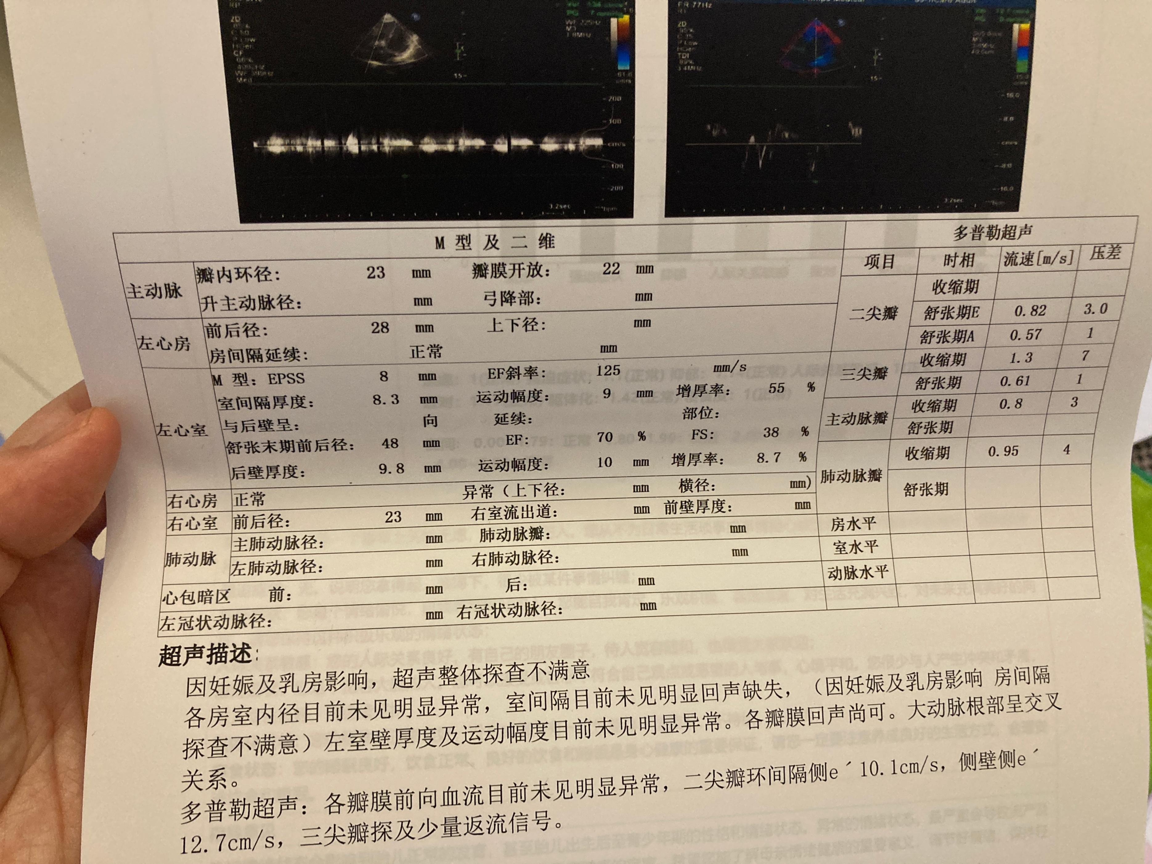 产科建档全过程,产科建档流程宝鸡