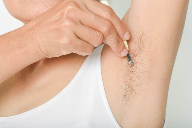 女生体毛多该不该刮掉,女生体毛多怎么办去除体毛有妙招