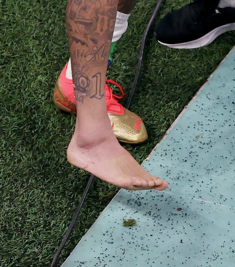 内马尔脚踝冰敷被队医扶着,内马尔脚踝90度扭曲队医