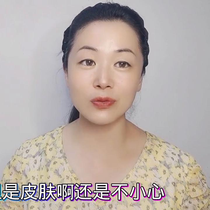 晒后过敏发红用什么精华,晒后皮肤敏感发红紧绷怎样修复