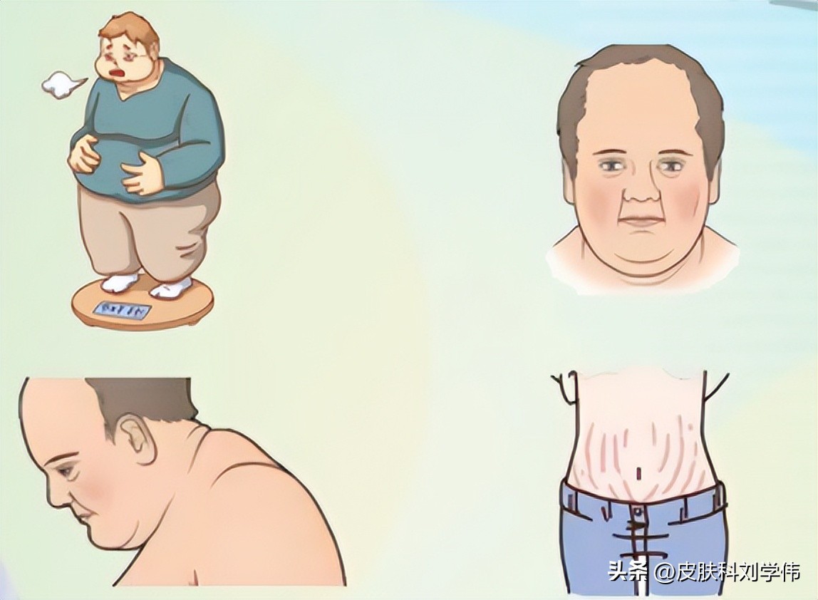 白癜风越治越多三个方法彻底治好,治疗儿童白癜风会存在哪些误区