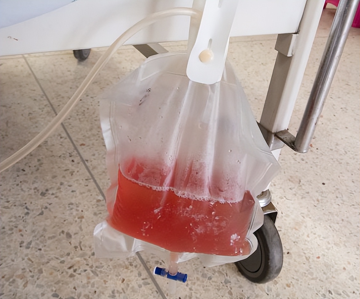 泌尿系统术后腹胀怎么处理,泌尿外科手术前后注意事项