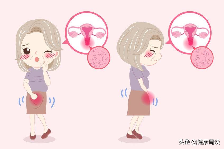 提醒女性：治疗阴道炎需避开4大误区，否则等于是给自己“挖坑”