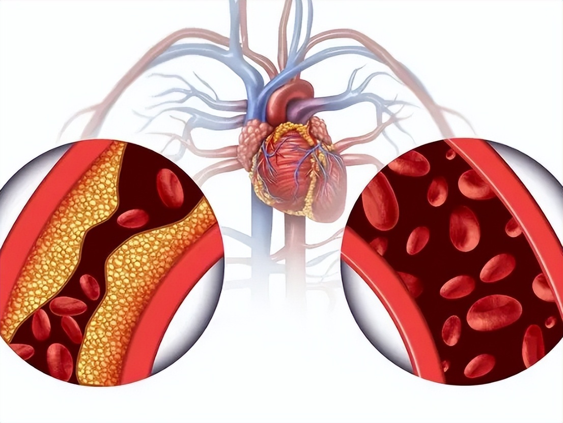 白岩松谈运动健康,白岩松运动治愈一切