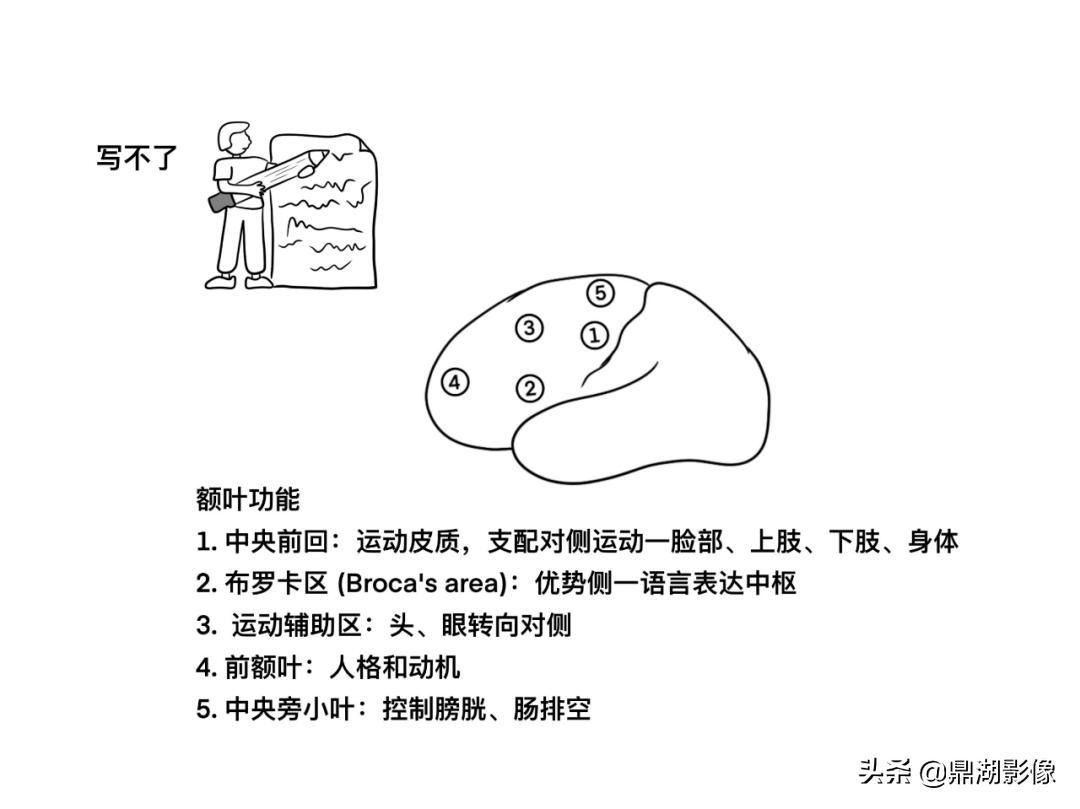 大脑皮层的解剖与定位,大脑解剖学习绘图笔记