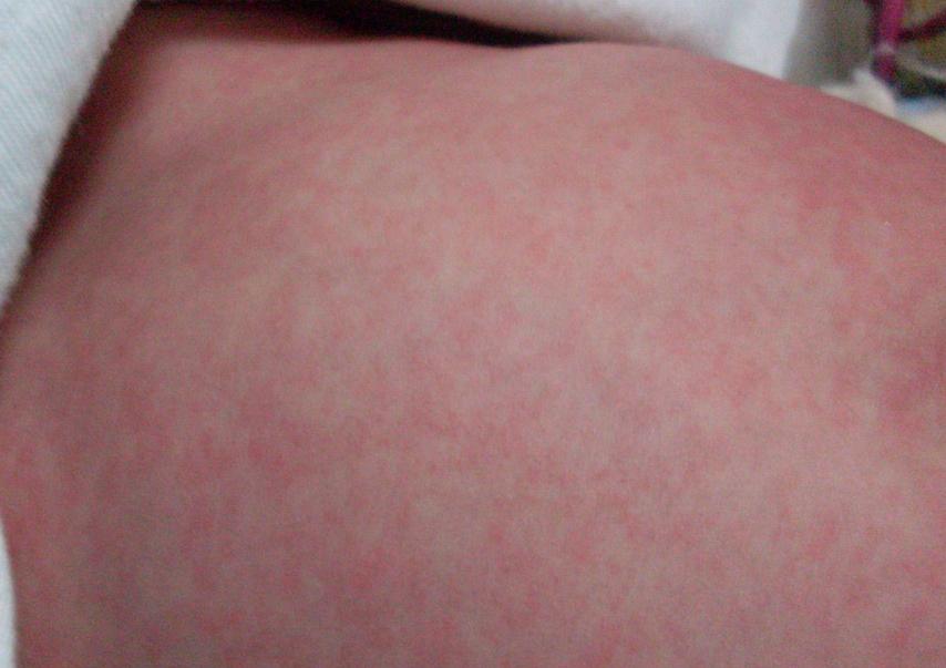 千万要注意六种寄生虫多的食物,提醒6种食物是寄生虫的重灾区