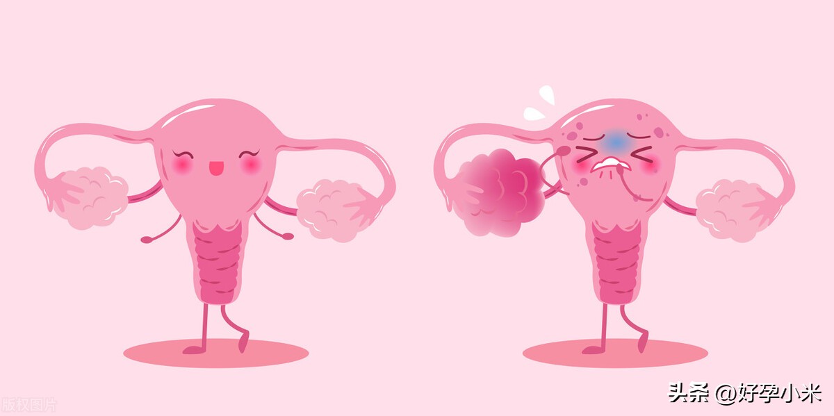 孕期见红是怎么回事呢,孕30周见红是什么原因