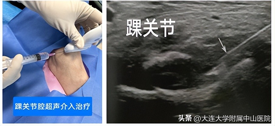 西安肌骨超声精准治疗,门诊超声