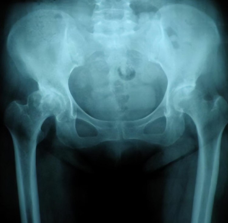 2013年西班牙富商恋上中国大妈，不惜放弃亿万资产，女方：不领证