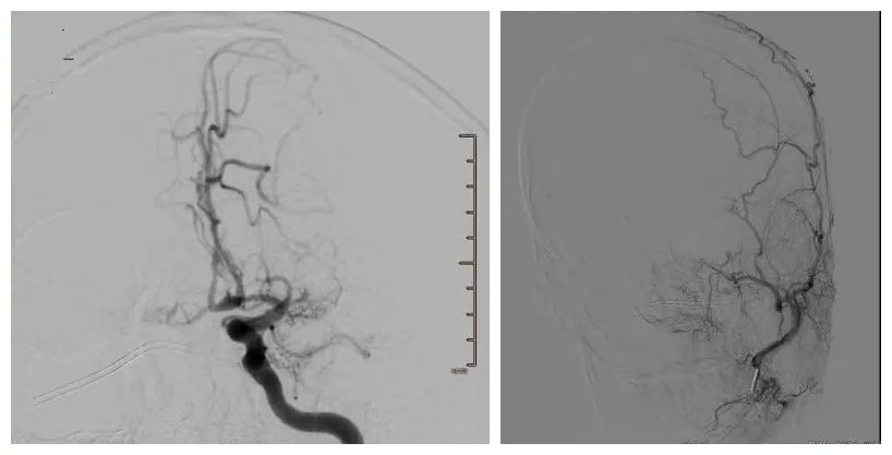 头昏眼花全身无力是不是中暑,头晕眼花是没休息好吗