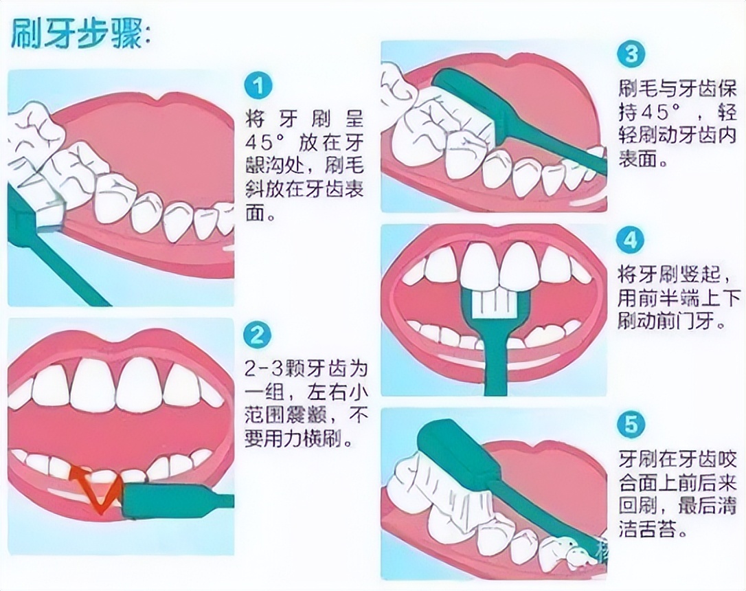 儿童电动牙刷有年龄限制吗,电动牙刷用法不正确有什么副作用