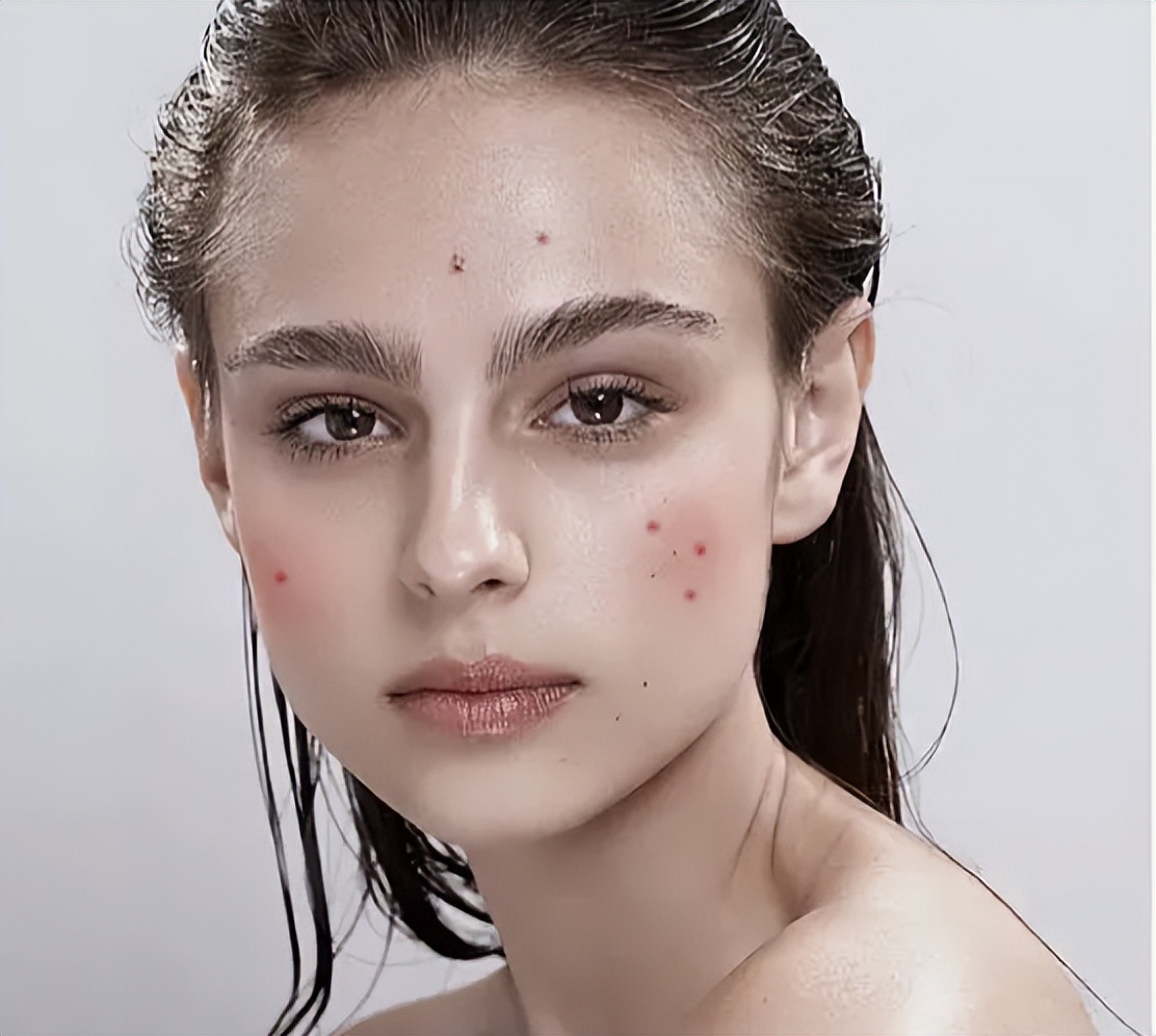 情绪护肤敏感肌,情绪美容芳疗系列化妆品