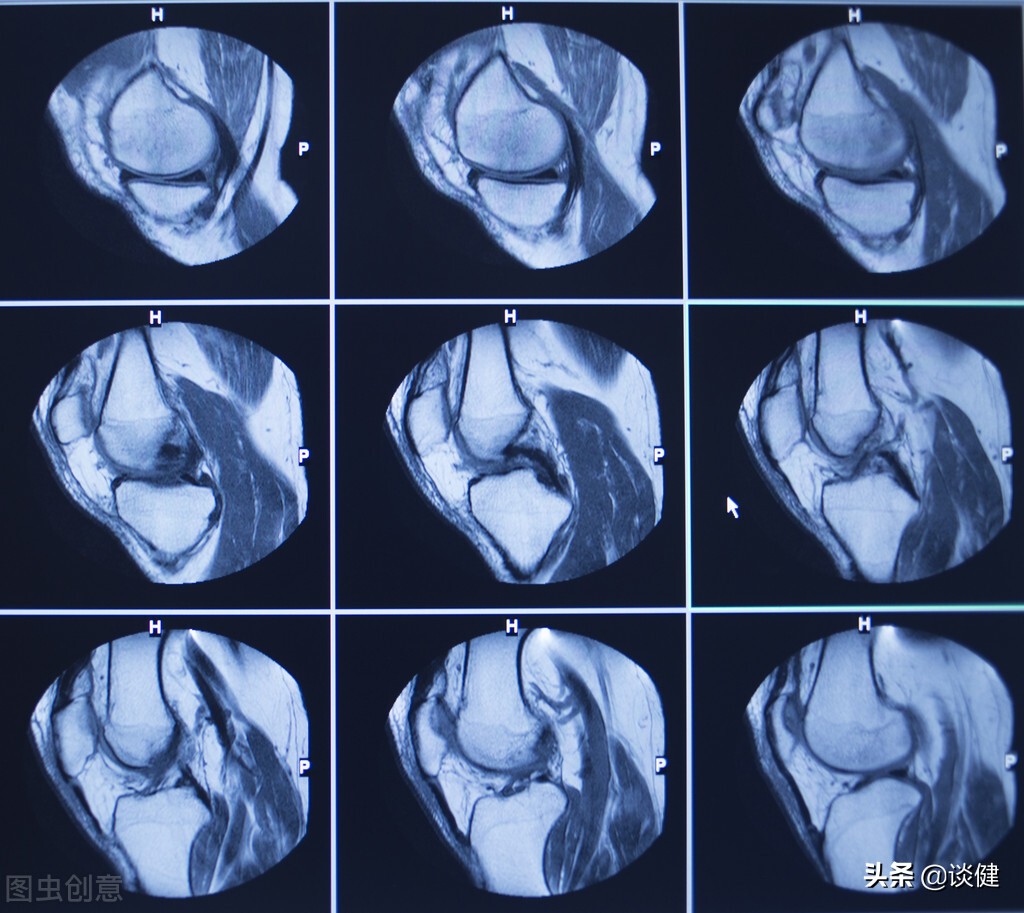 老人运动过度对身体的危害,中老年人运动应注意哪些问题