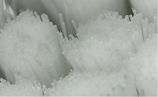 什么样的牙齿应该用电动牙刷,补过牙用电动牙刷的好处和坏处