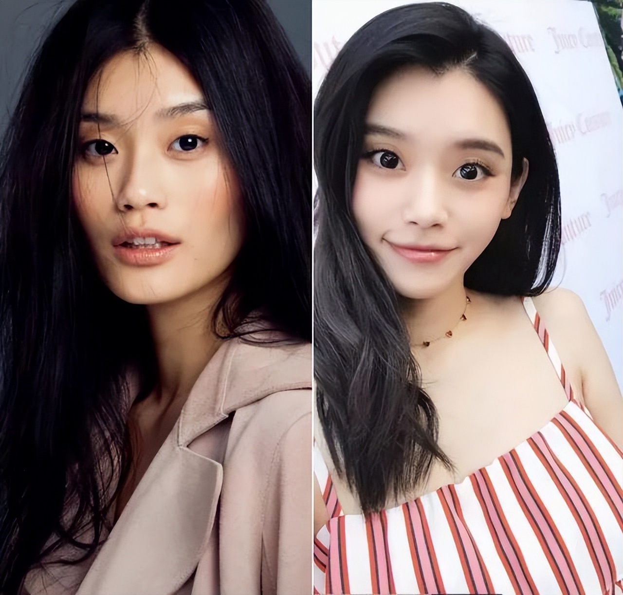 奚梦瑶整容了?鼻翼缩小,满满幼态,戴钻戒大秀恩爱