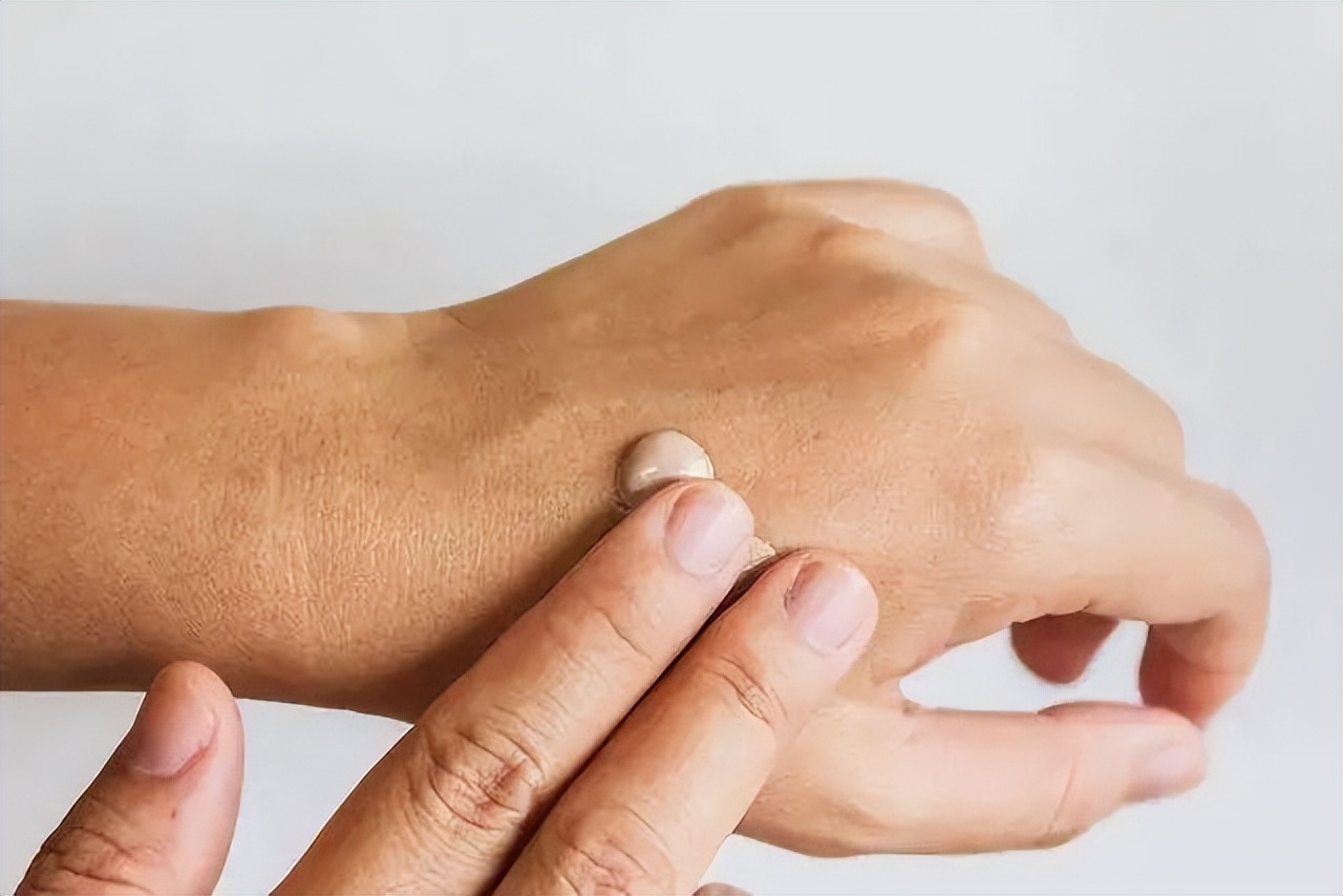 炉甘石洗剂大概要多少钱,炉甘石洗剂一般多少块钱