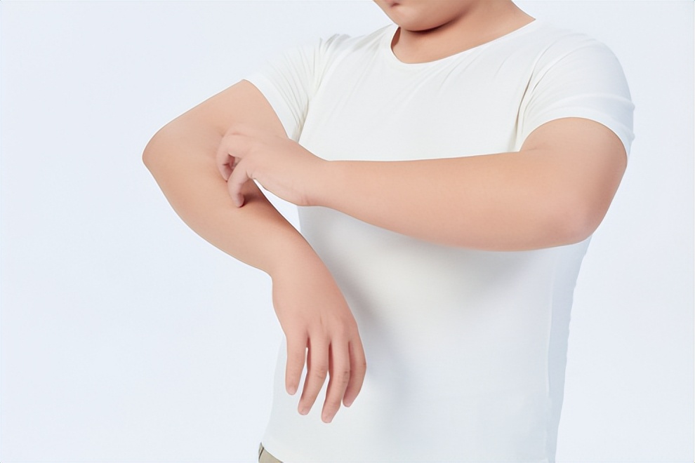 怎样判断宝宝湿疹和热疹,怎么判断小孩湿疹跟热疹