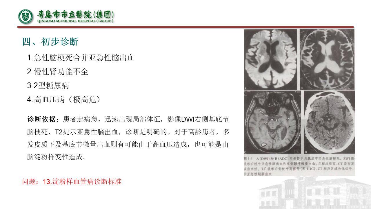 神经内科疾病临床诊疗思维,神经内科理论知识总结