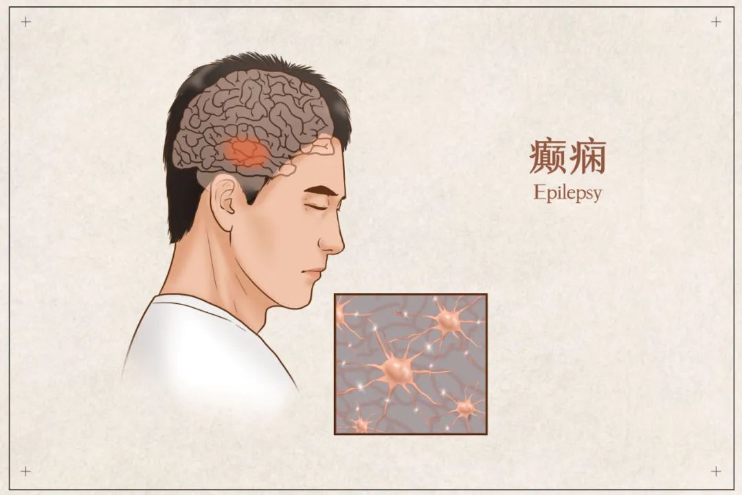 恶灵附身症状,恶灵附身大脑