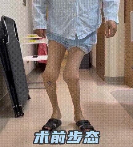 血友病患者的福音,禾正骨科助您完成轮椅上的“逆袭”!