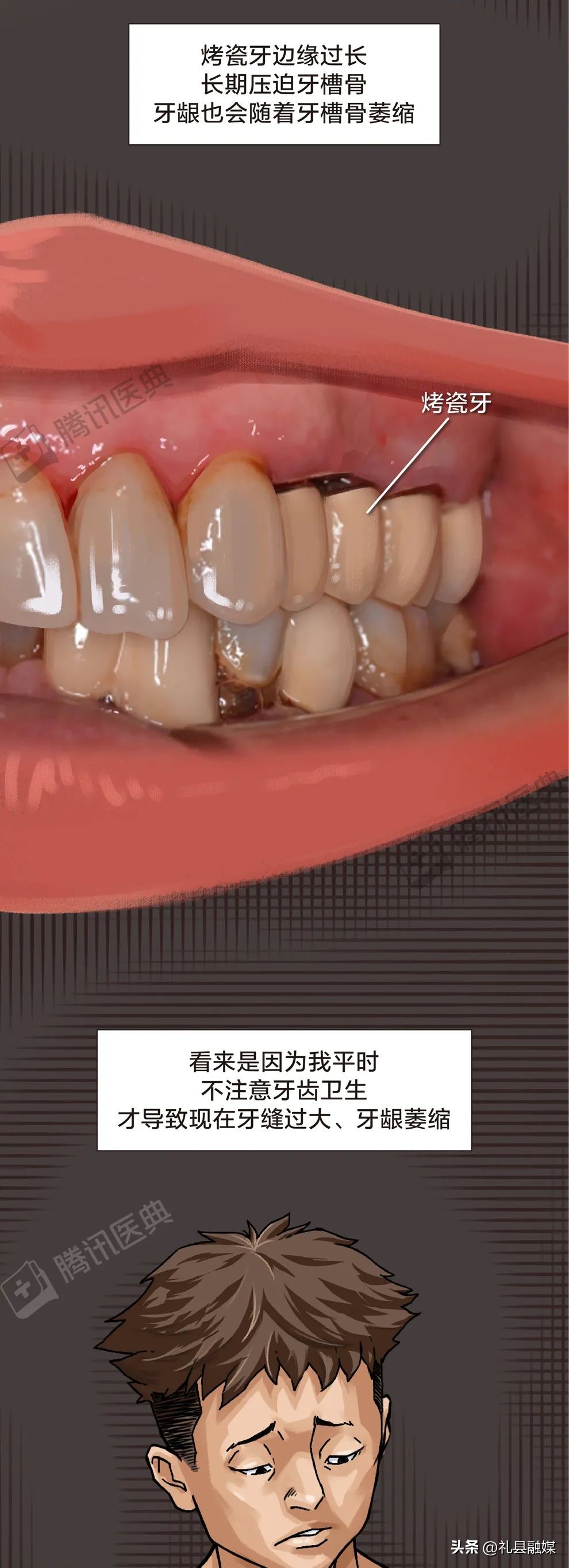 牙缝隙大吃菜就塞牙怎么修复,牙齿吃菜老塞牙怎么办