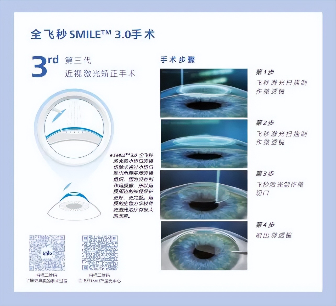 全飞秒和半飞秒近视手术如何选择,近视全飞秒和半飞秒手术哪个好点