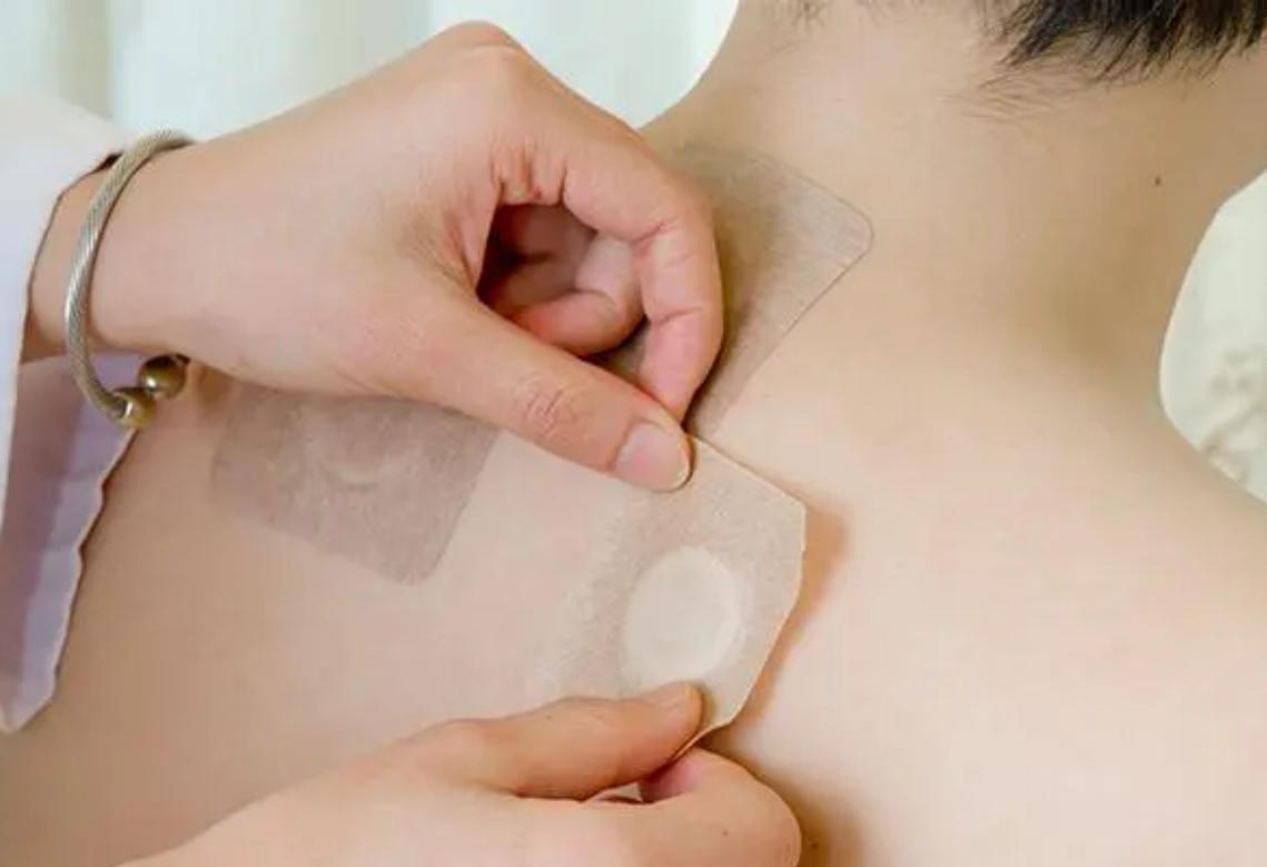 过敏性鼻炎的中医治疗方法有哪些,变应性鼻炎中医疗法