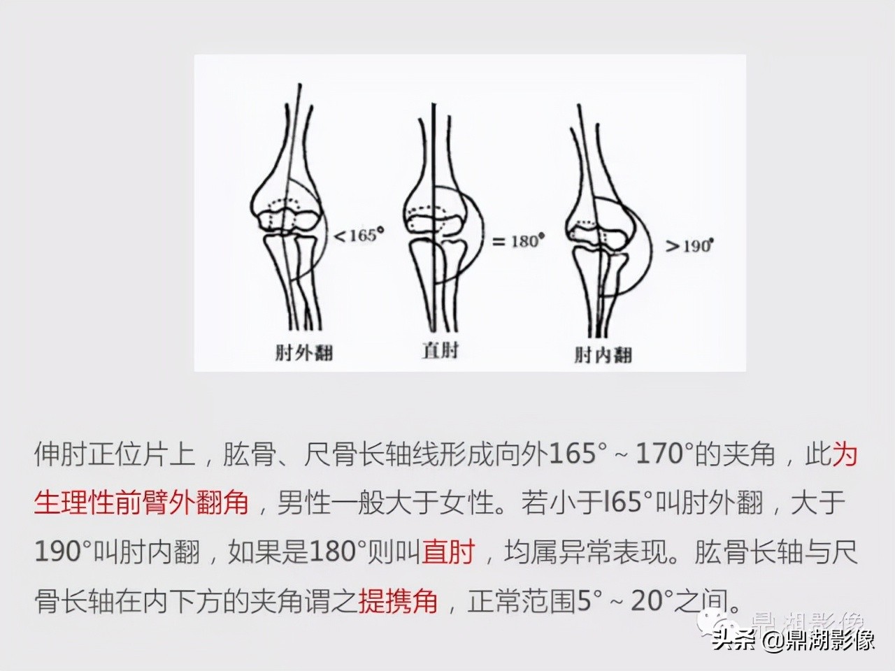 先天桡骨缺失畸形能治疗吗,先天性桡骨发育不良
