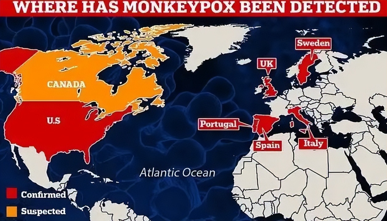 猴痘最新事件,猴痘事件什么时候开始的