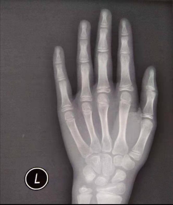 7岁孩子为什么早熟,孩子才7岁为什么医生说她早熟呢