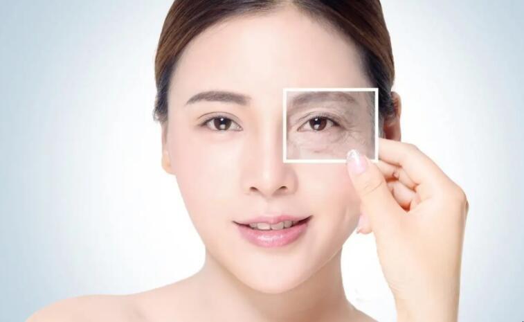 什么是鱼尾纹,有了鱼尾纹该如何补救