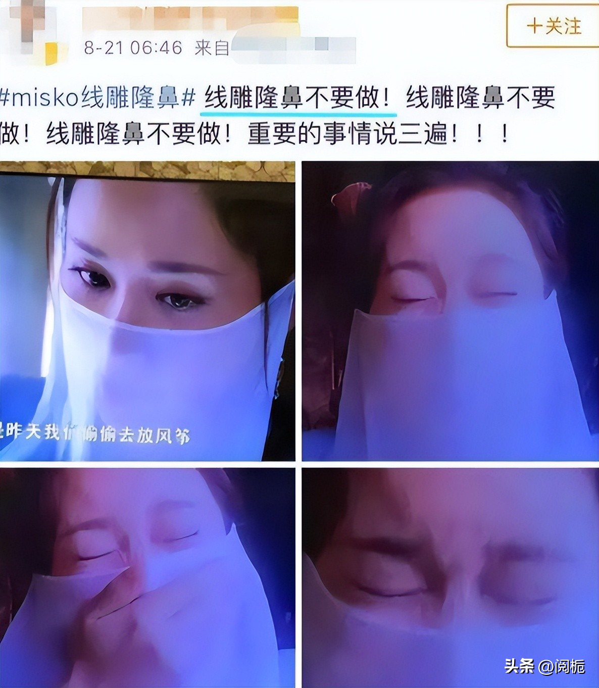 靠换脸逆天改命的六位女星,长得歪瓜裂枣整得美若天仙的明星