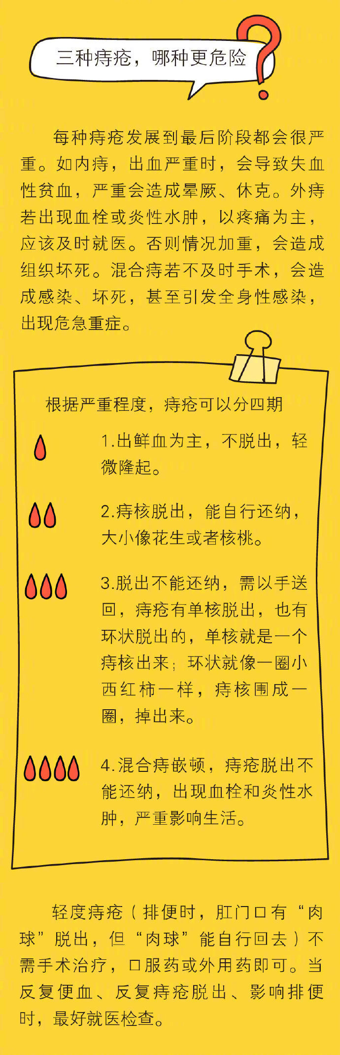痔疮套扎手术的操作流程,痔疮内痔手术的操作流程
