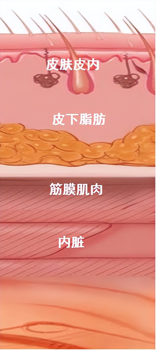 剖宫产从麻醉到伤口缝合需要多久,剖宫产伤口渗血渗液要再次缝合吗