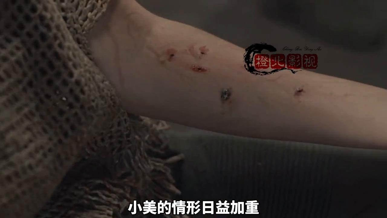 女孩被真菌感染发生了变异,女性真菌感染如何治愈