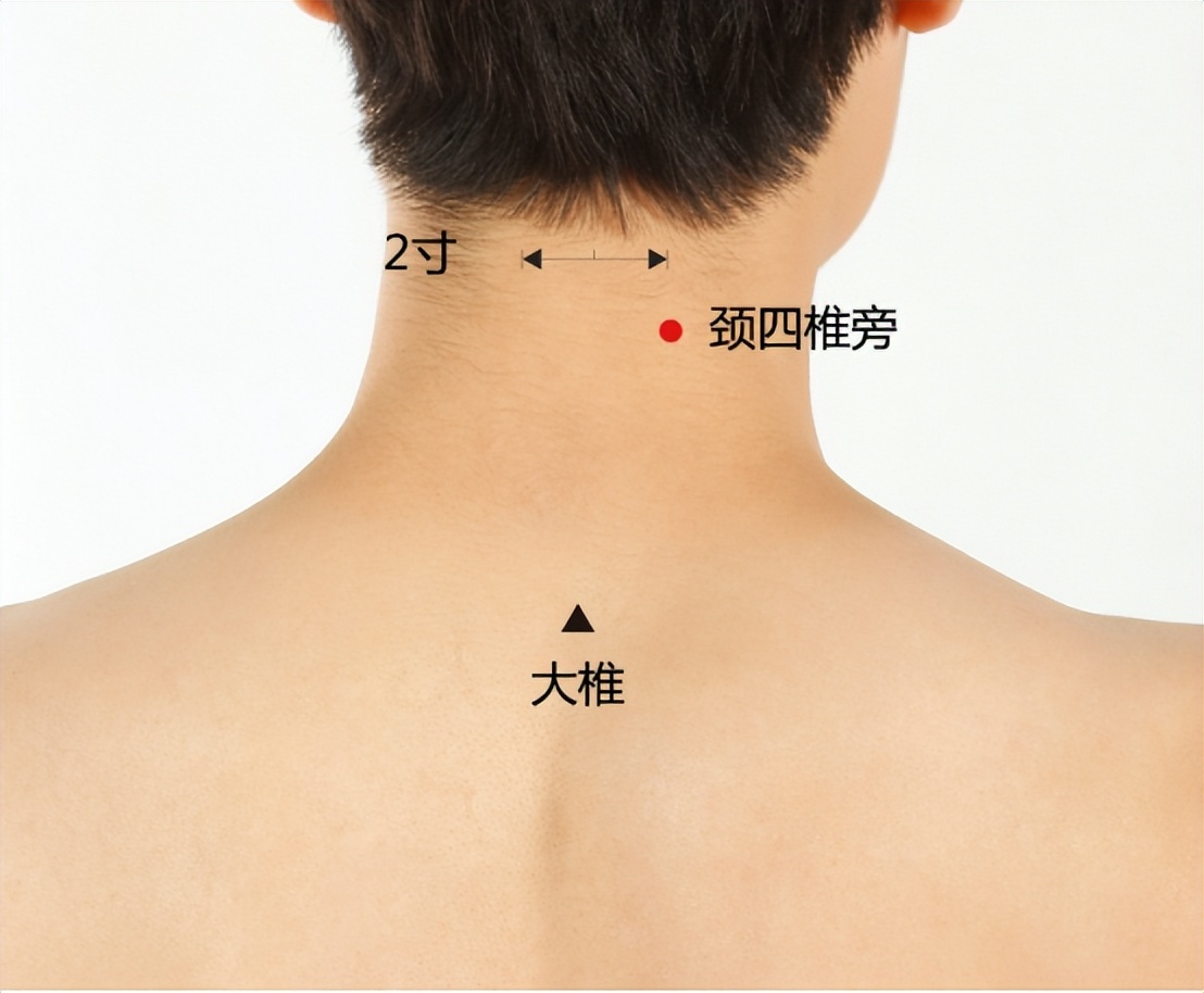 额头脖子出汗的止汗方法,颈部容易出汗中医看哪个科