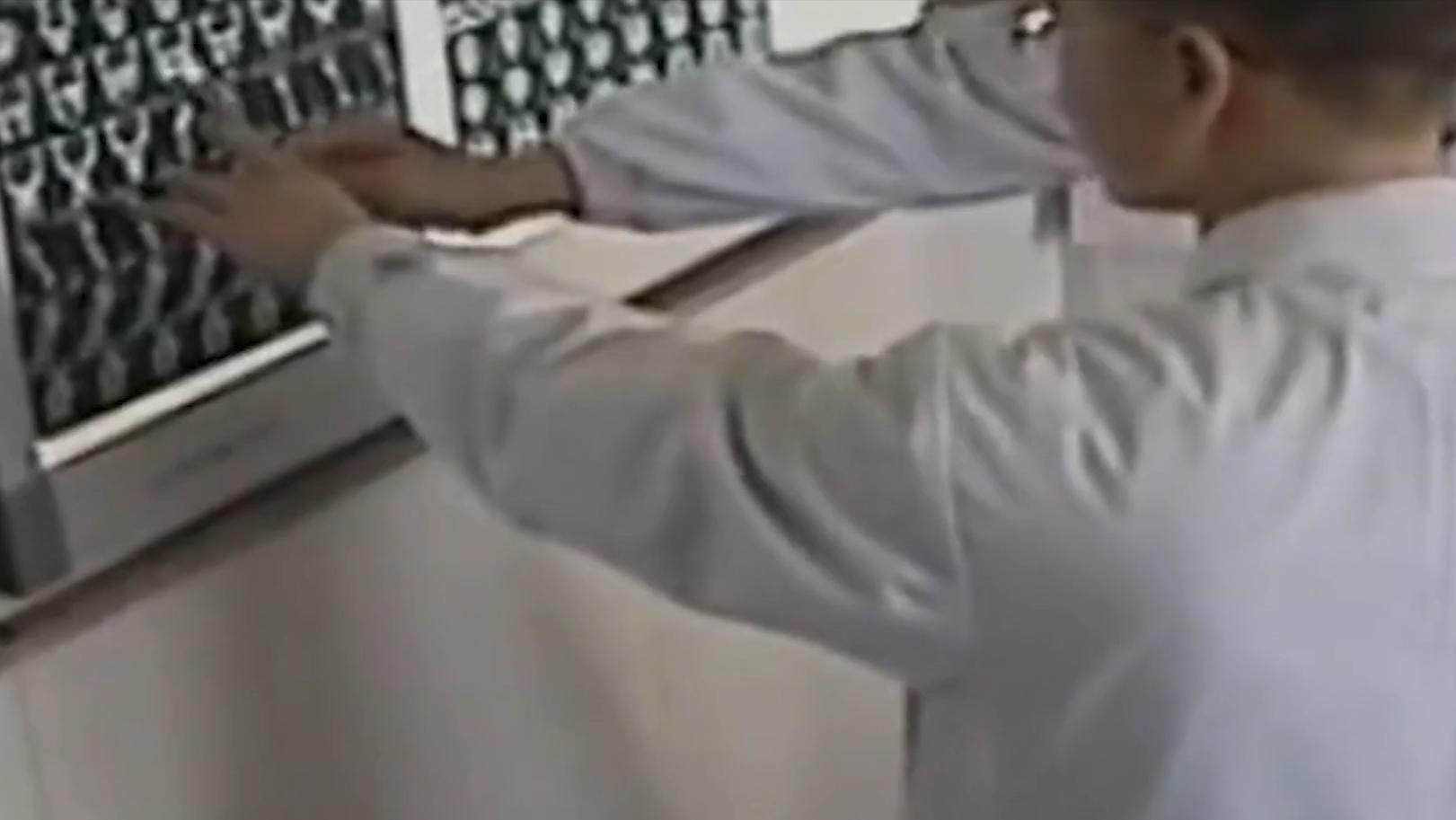 云南男子口臭手术后现在怎么样了,云南男子口臭查出了大毛病