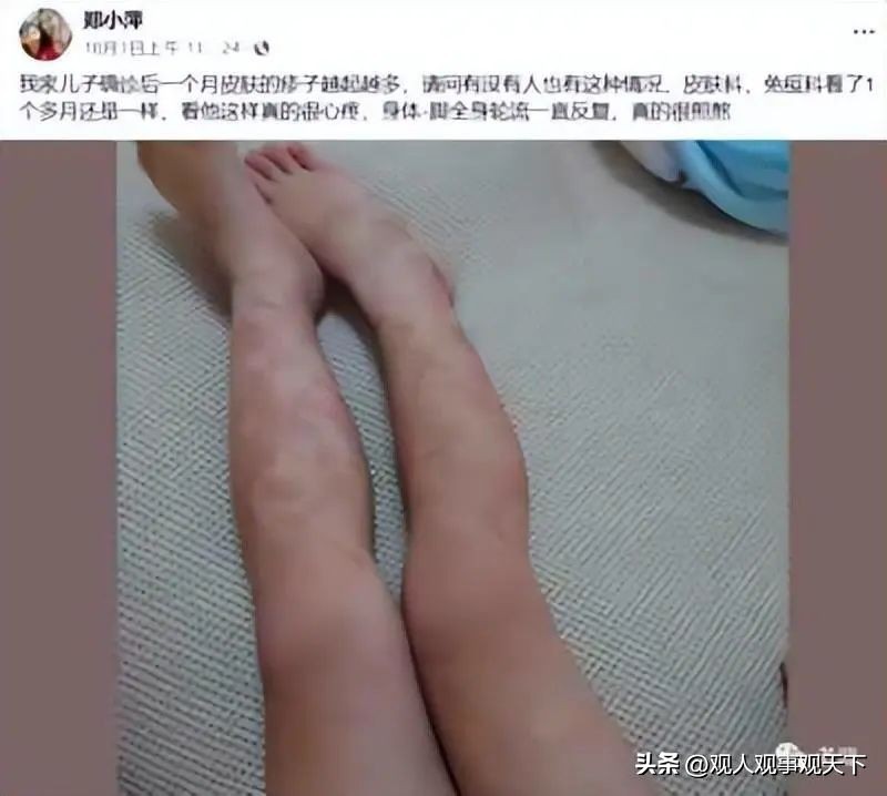 有没有新冠患者交流论坛,龙口有没有新冠疫情