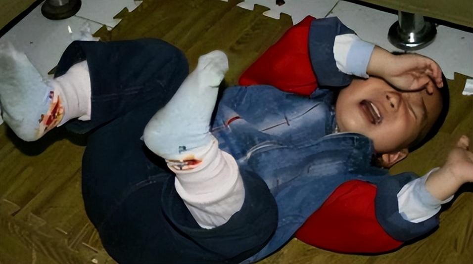 7岁男孩眼球被炸后融化,七岁男童眼睛秒被溶化