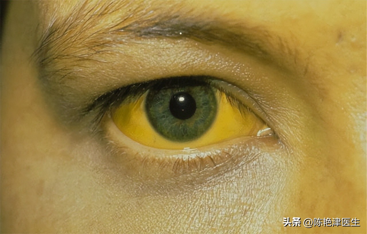 肝不好头部先知,肝变硬头部会有什么反应