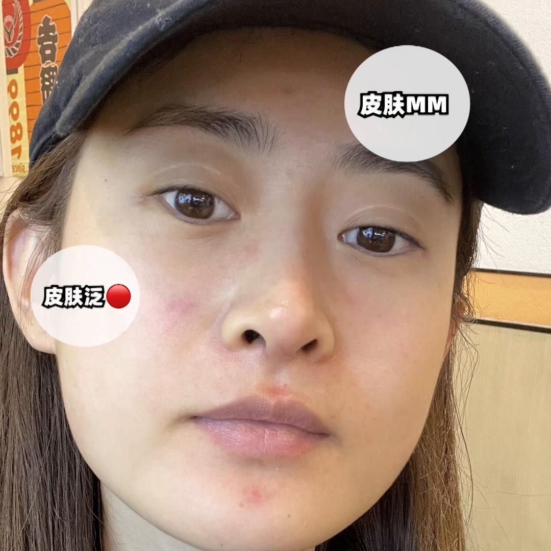 皮肤科推荐护肤产品,皮肤科院线好物