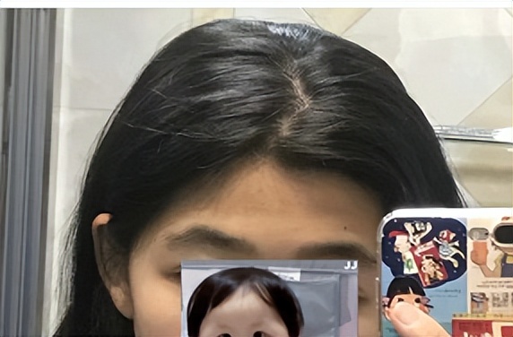 发际线对颜值的重要性,发际线对颜值的影响