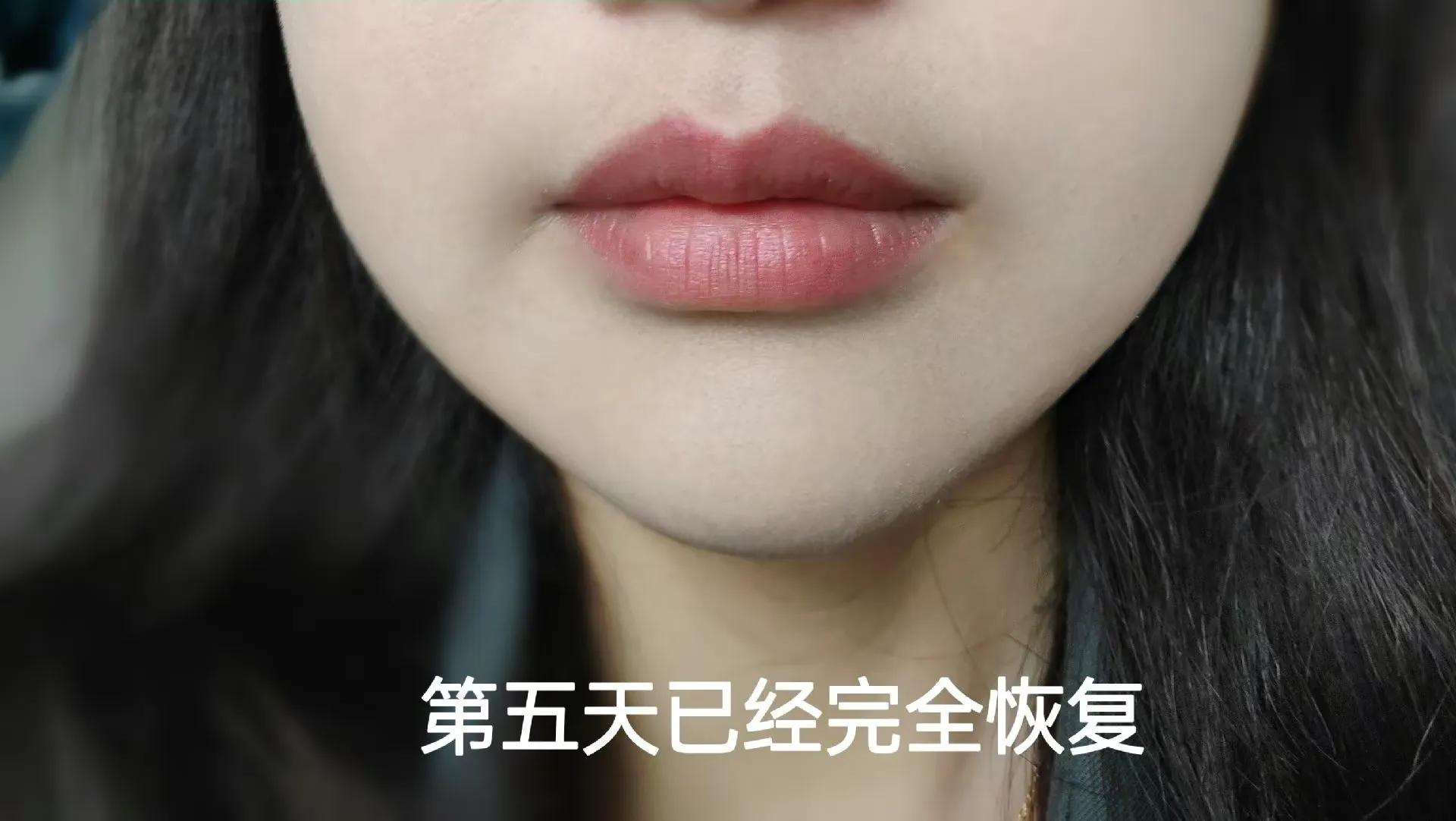 纹唇多久会全部掉色完,纹唇有什么不好的地方吗