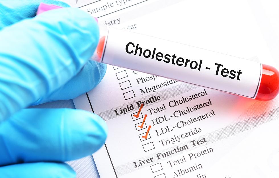 中老年人体检应该检查哪些项目,中老年人一年体检都检查什么