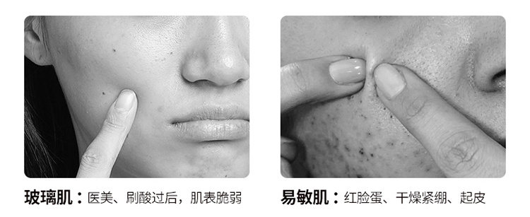 澳赞深海鱼油鸸鹋油修护霜,滴倍